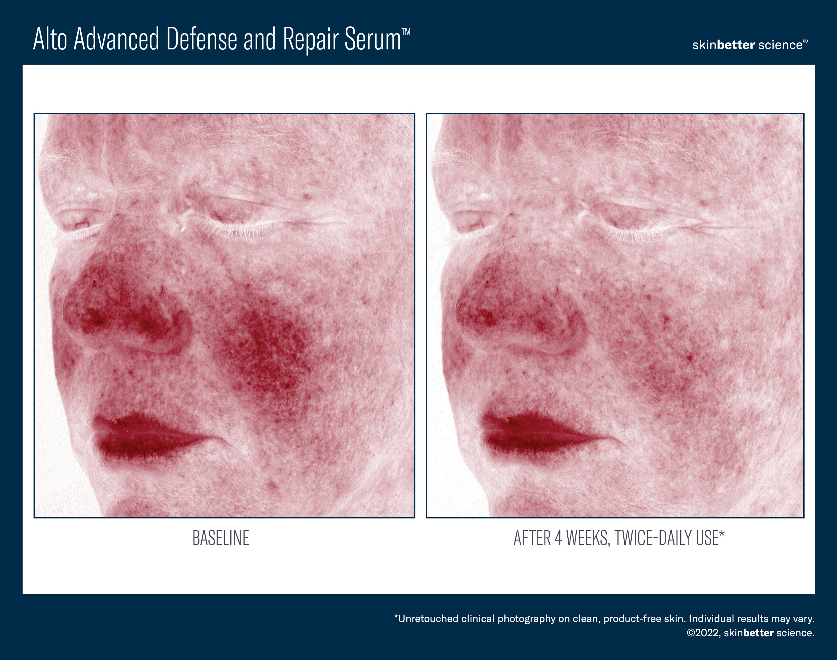 Skinbetter Alto Advanced Antioxidant Defense and Repair Serum