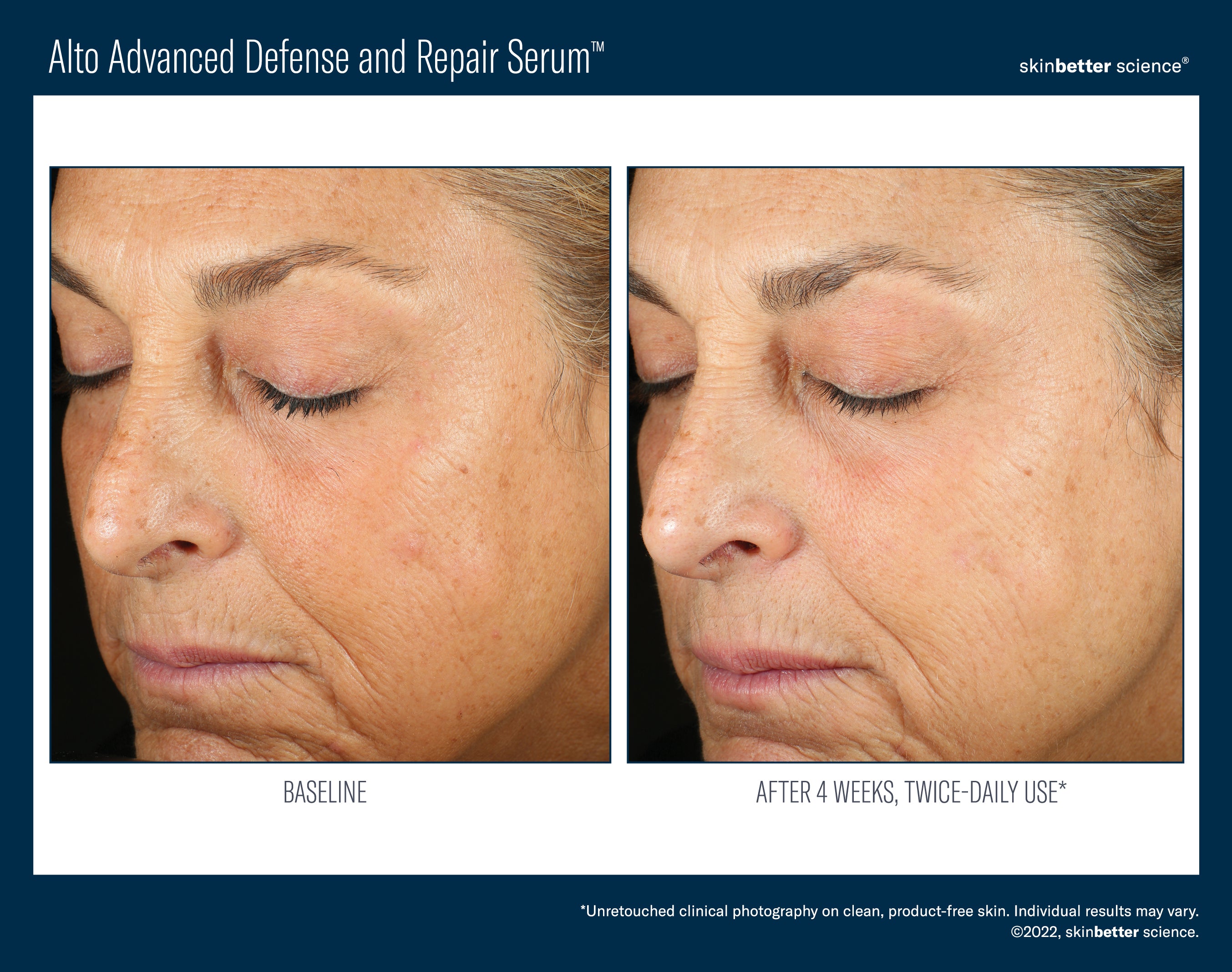 Skinbetter Alto Advanced Antioxidant Defense and Repair Serum