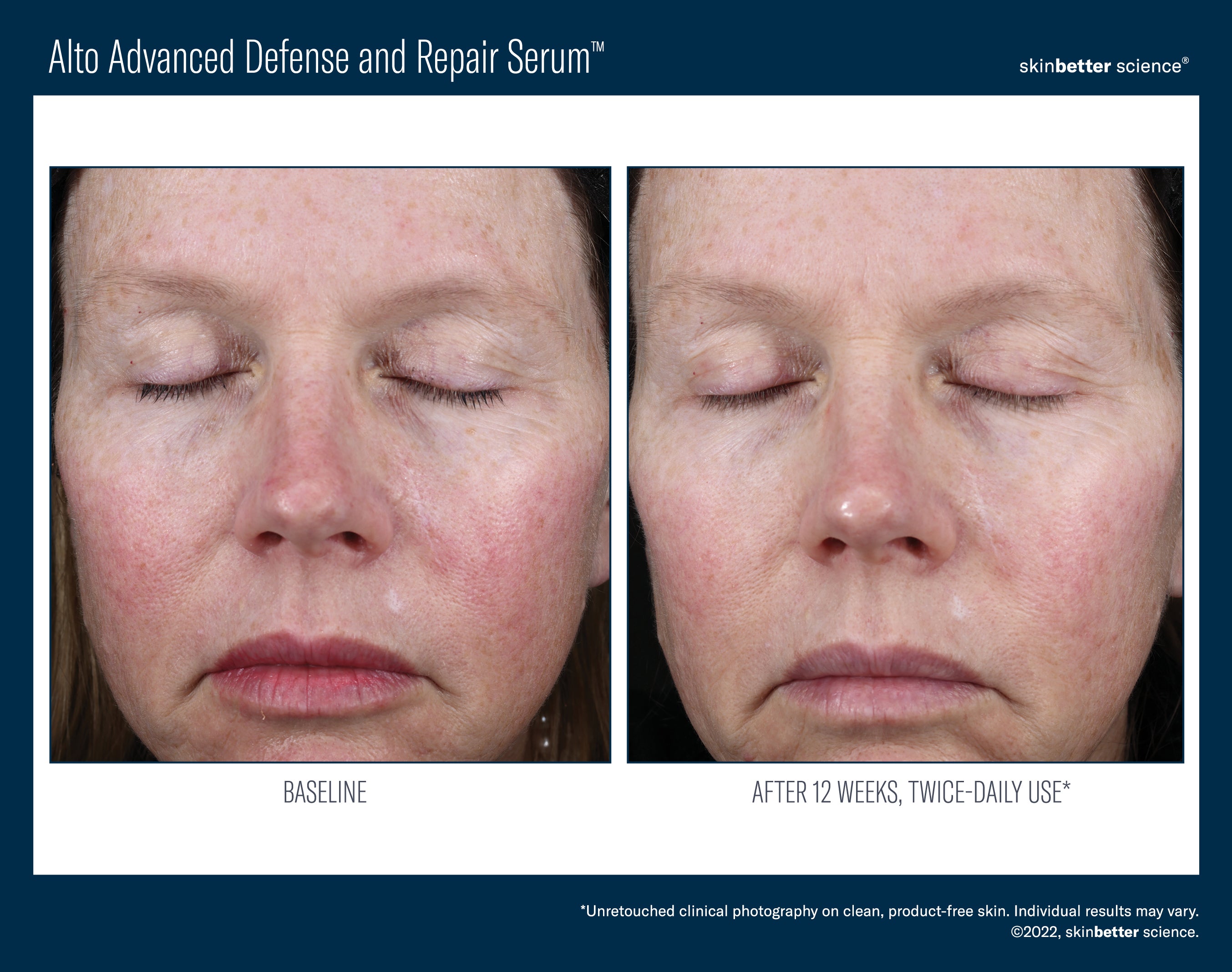 Skinbetter Alto Advanced Antioxidant Defense and Repair Serum