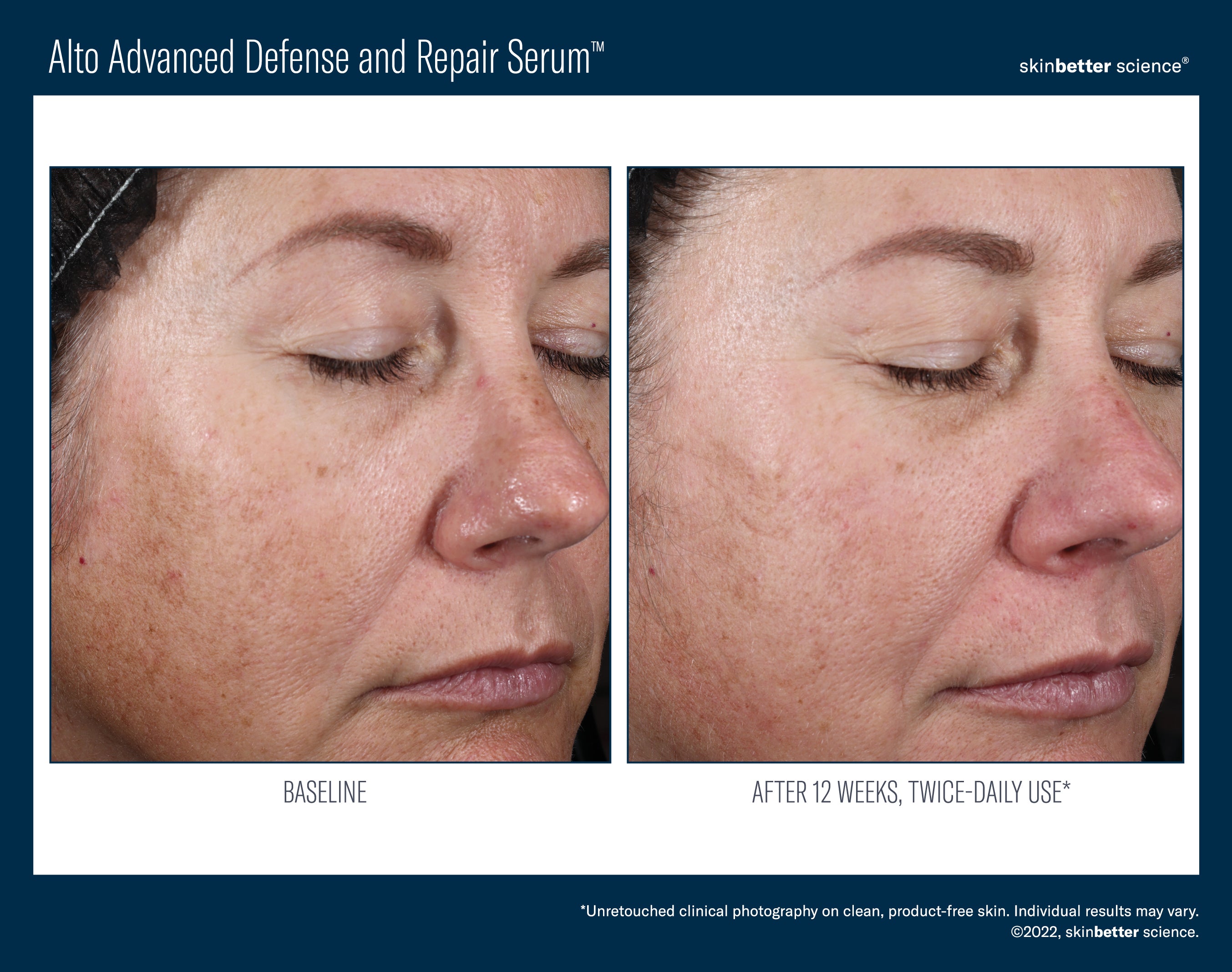 Skinbetter Alto Advanced Antioxidant Defense and Repair Serum