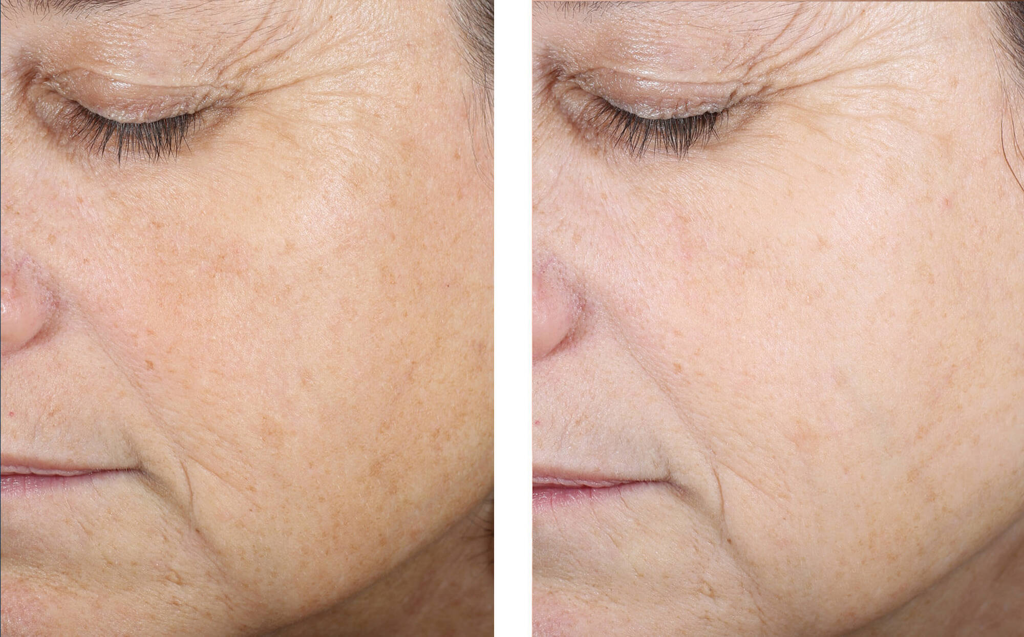 SkinBetter Even Tone Correcting Serum