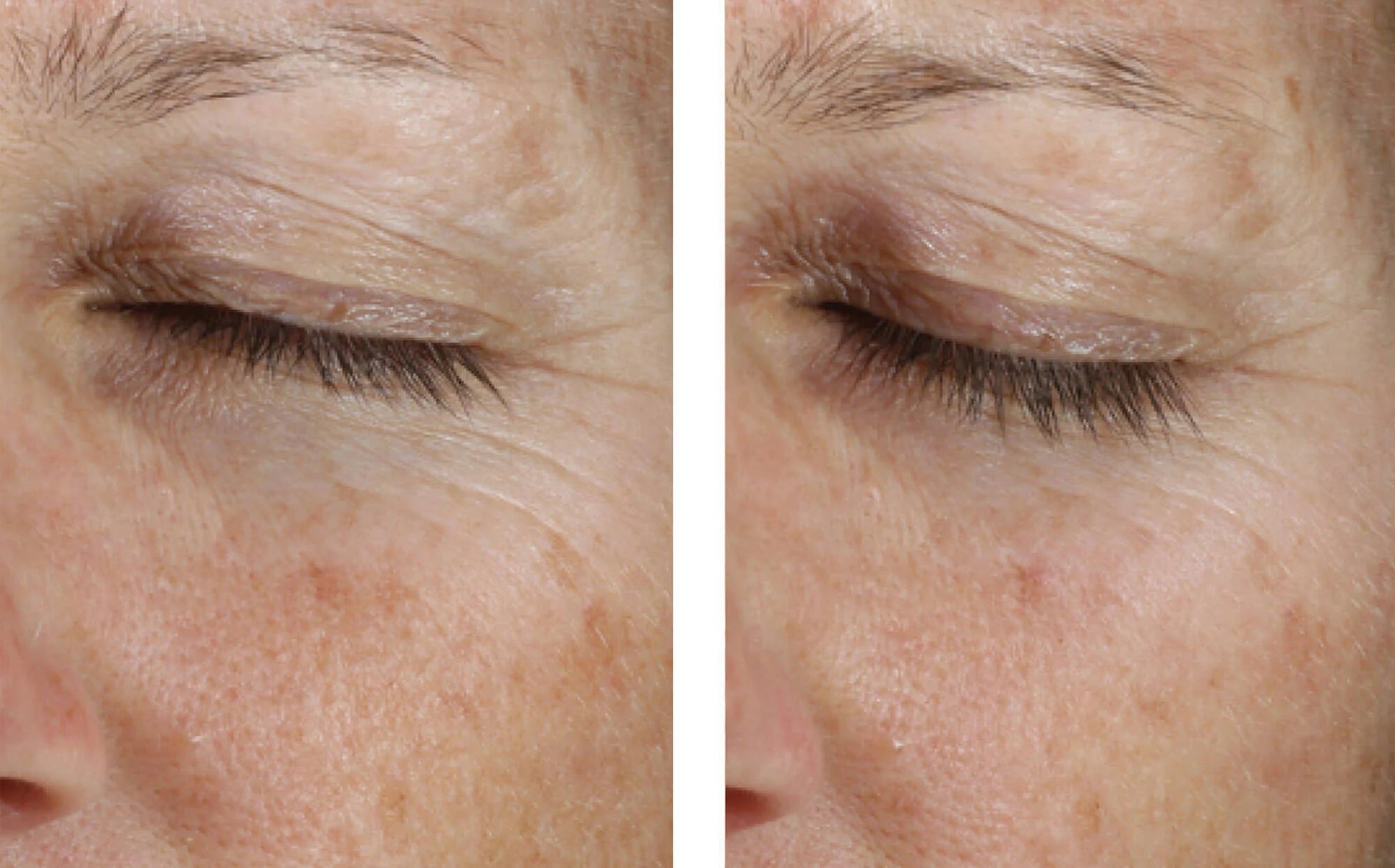 SkinBetter Instant Effect Gel EYE