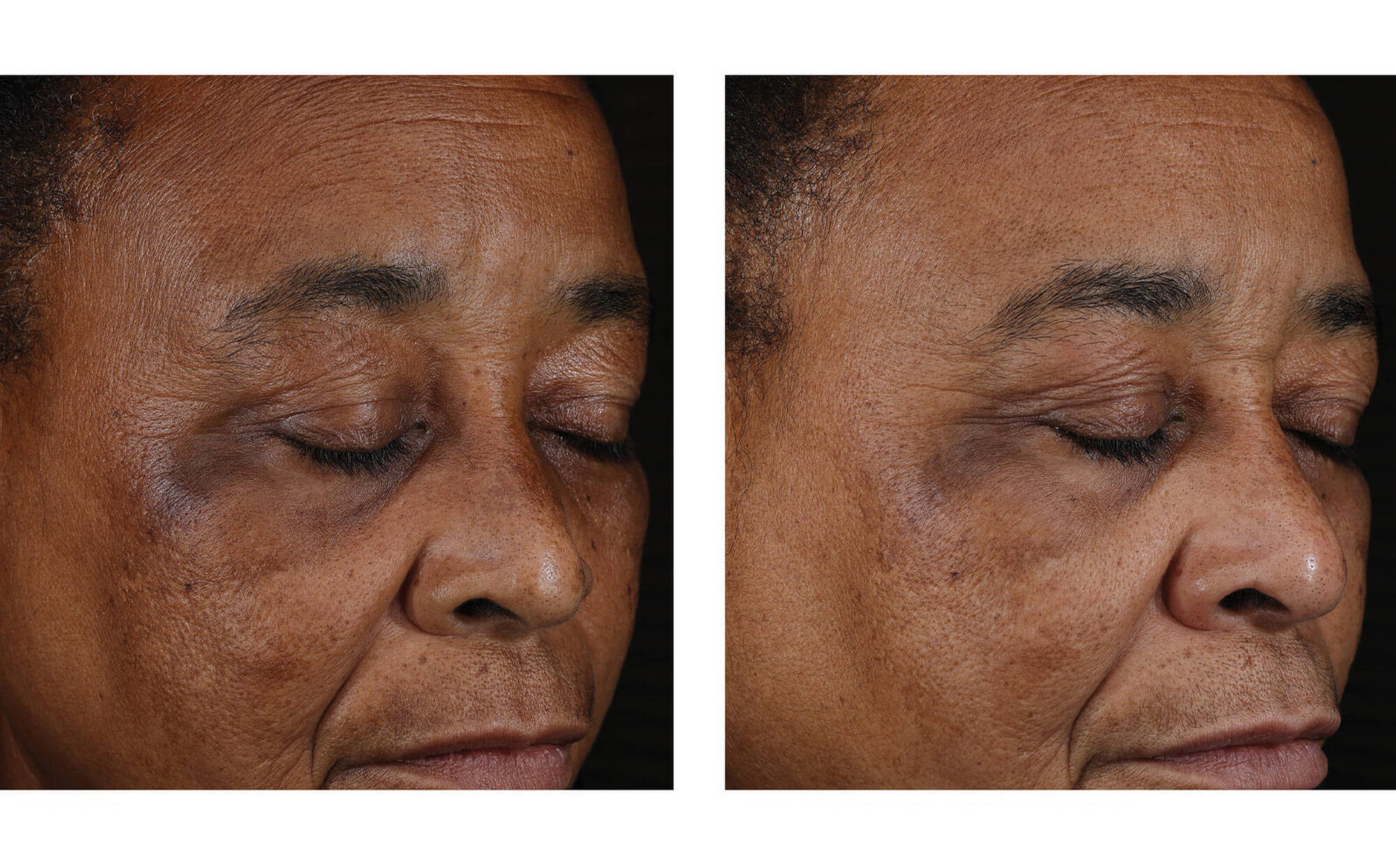 Skinbetter Mystro Active Balance Serum