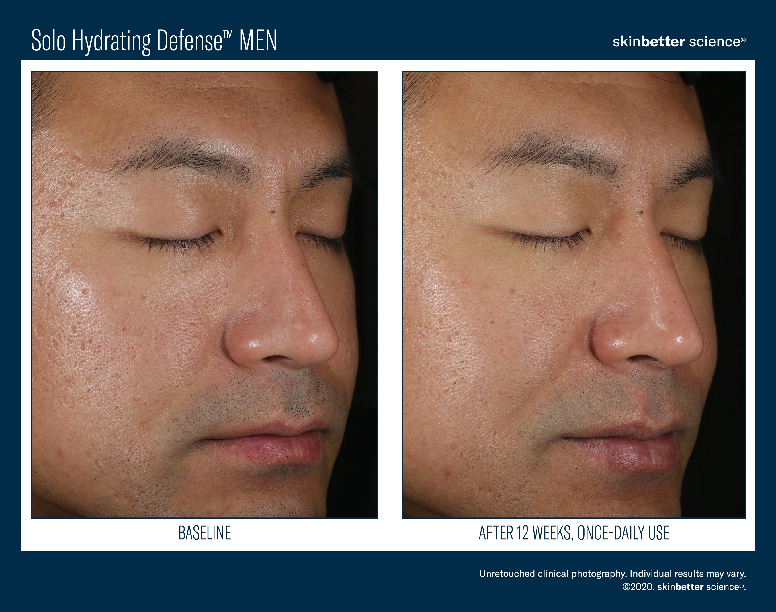 SkinBetter Solo Hydrating Defense Men