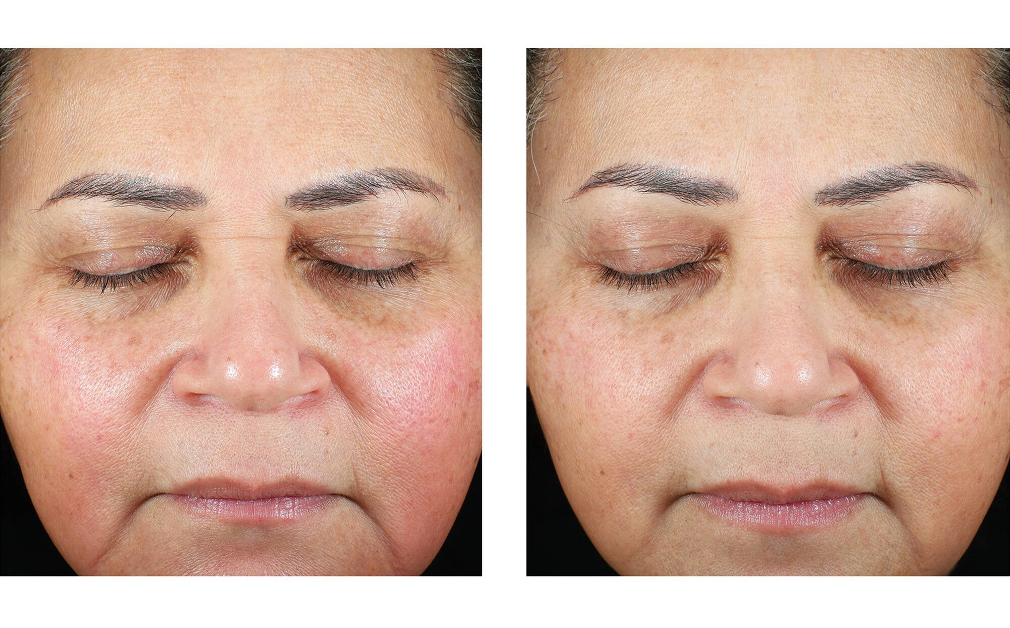 Skinbetter Trio Luxe Moisture Treatment