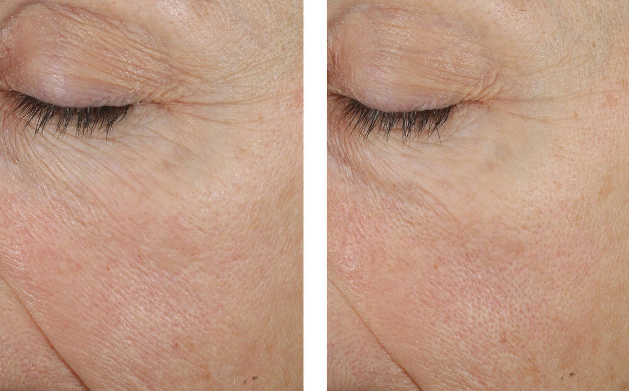 Skinbetter Trio Rebalancing Moisture Treatment