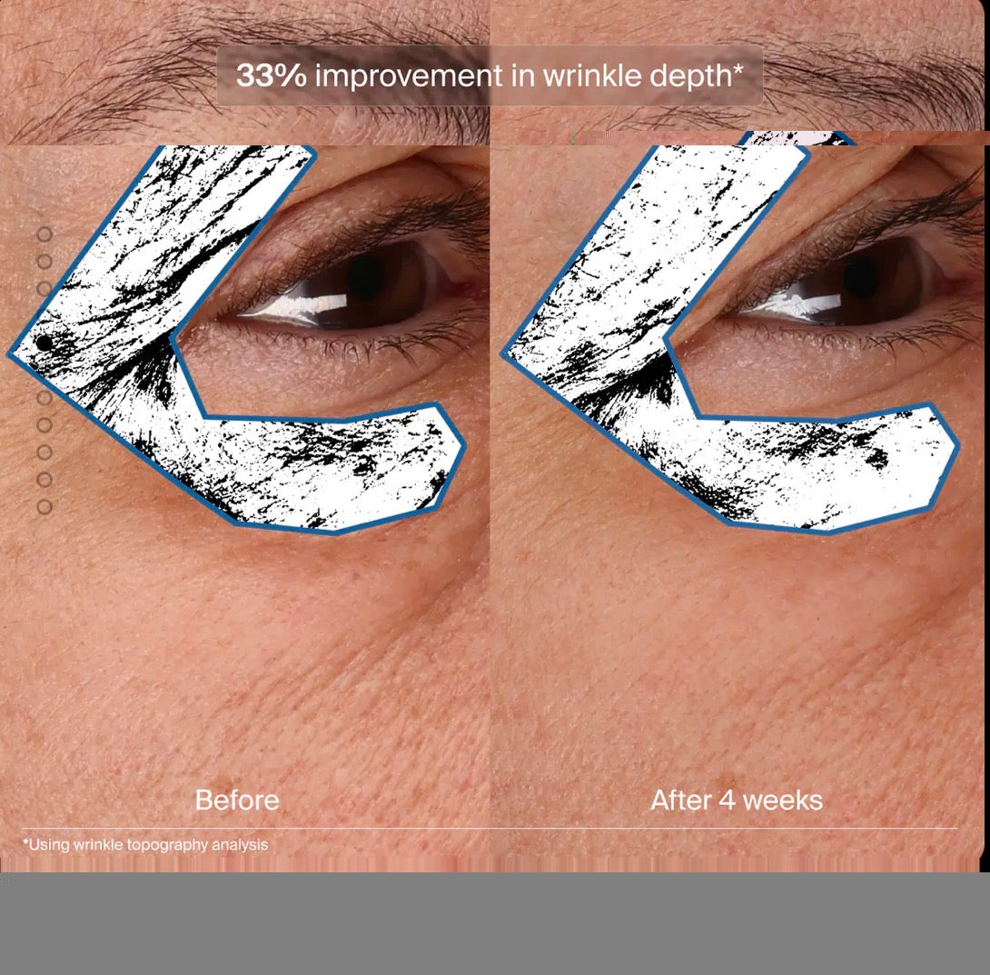 Bioadaptive Stress Repair
