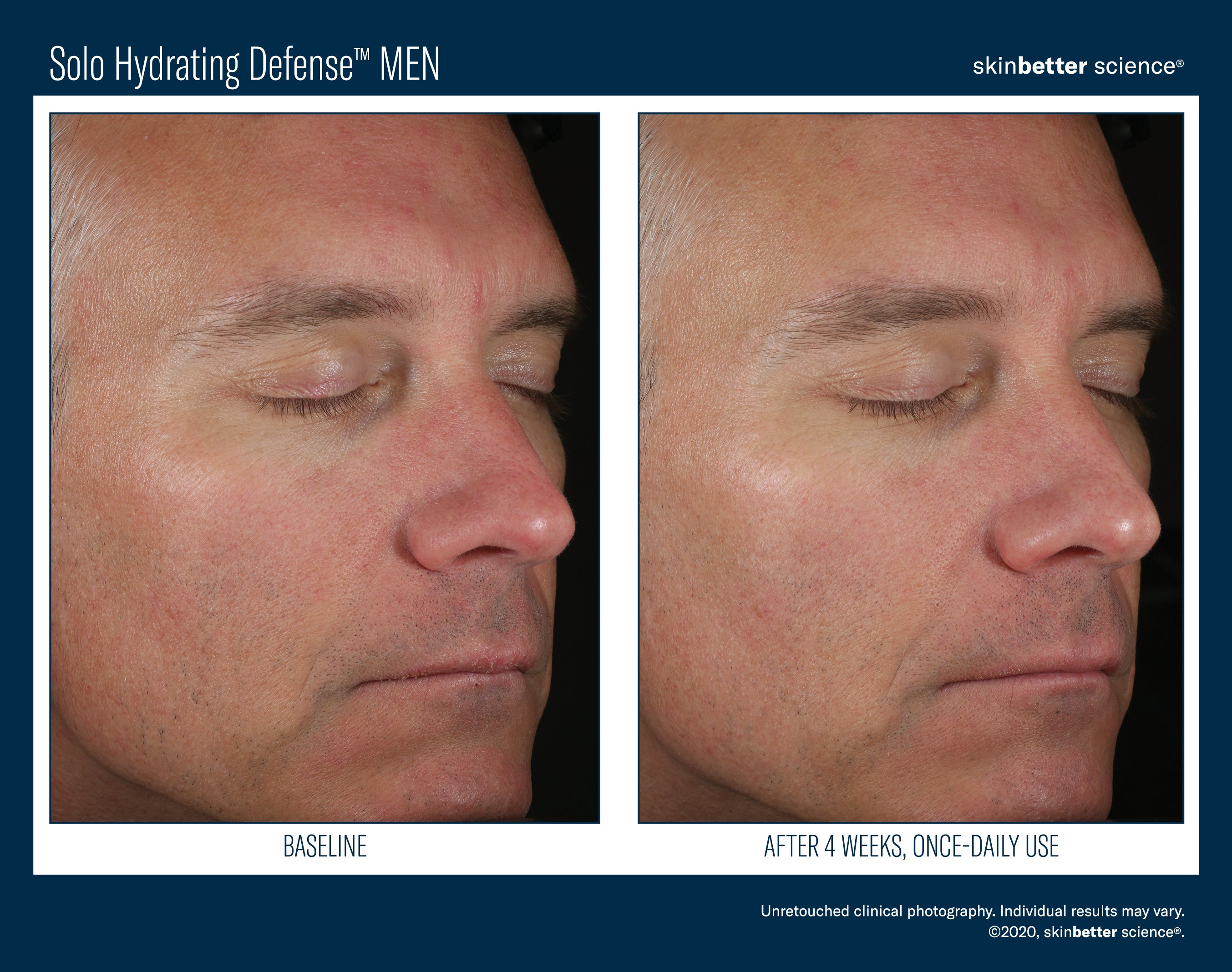 SkinBetter Solo Hydrating Defense Men